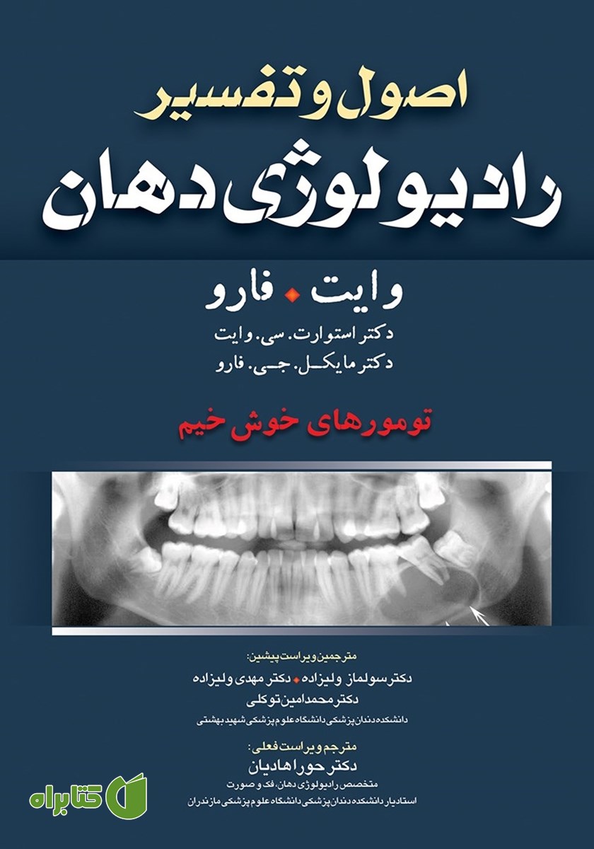 کتاب اصول و تفسیر رادیولوژی دهان وایت فارو: تومورهای خوش خیم
