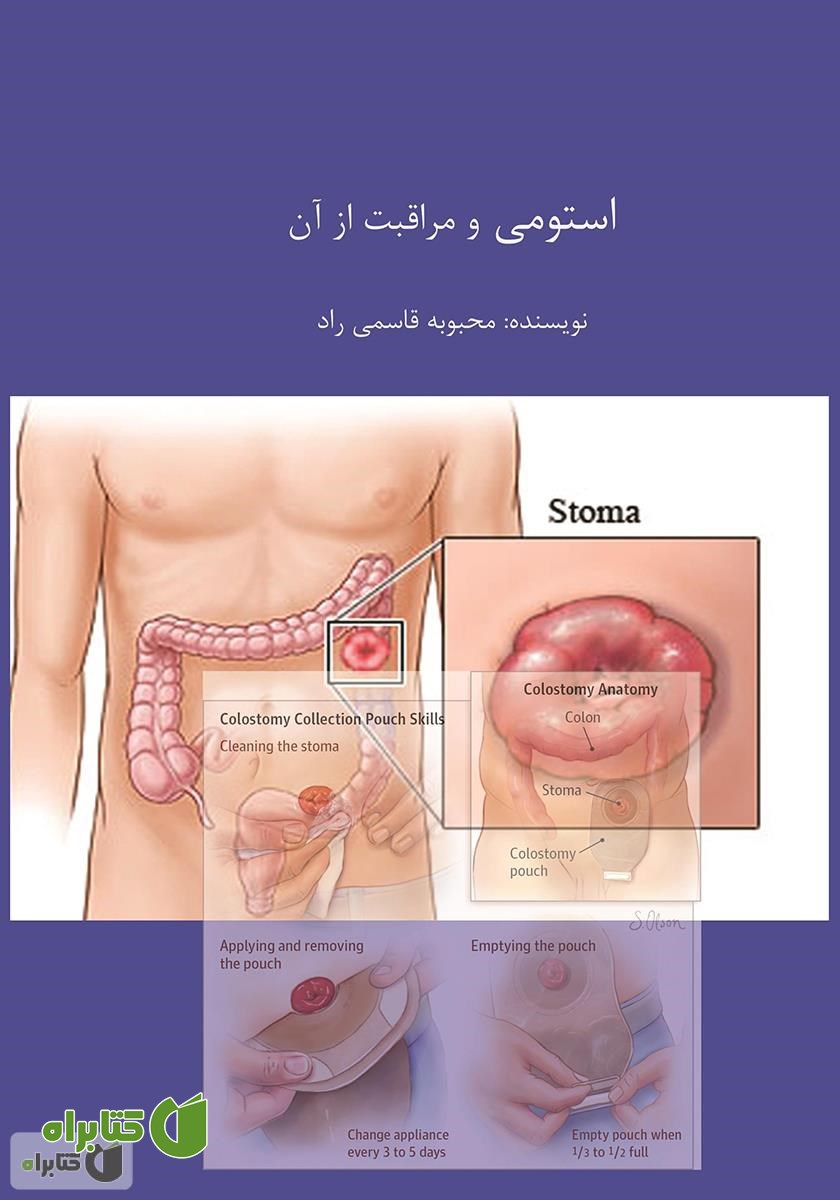 کتاب استومی و مراقبت از آن