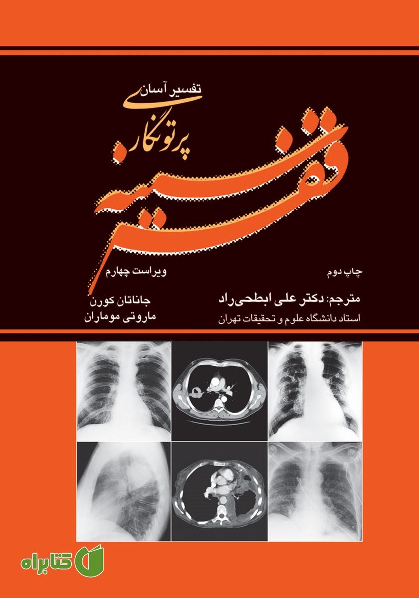 کتاب تفسیر آسان پرتونگاری قفسه سینه - ویراست چهارم