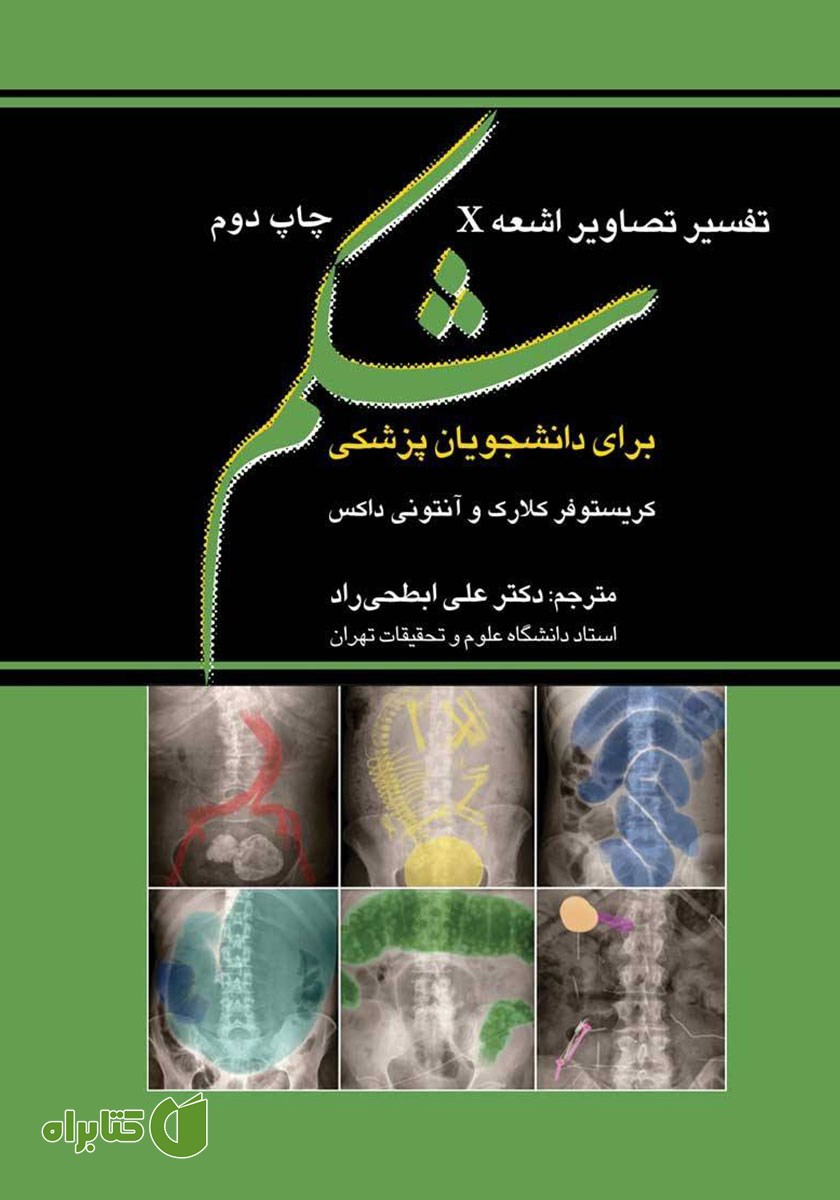 کتاب تفسیر تصاویر اشعه X شکم برای دانشجویان پزشکی