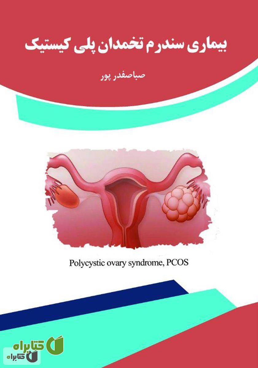 کتاب بیماری سندرم تخمدان پلی کیستیک