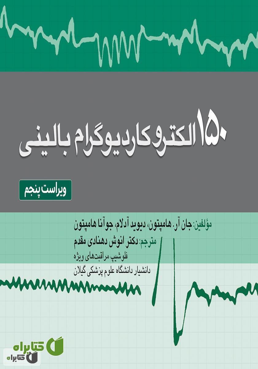کتاب 150 الکتروکاردیوگرام بالینی